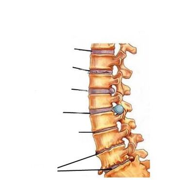 Entwicklungsphase der Osteochondose