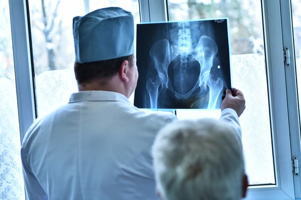 Der Arzt untersucht das Bild eines Hüftgelenks mit Arthrose